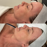 Even Tone Program – Dark Spots, Pigmentation & Uneven Tone