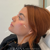 Cosmetic Aesthetics Consultation