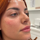 Cosmetic Aesthetics Consultation