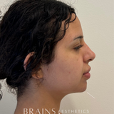 Cosmetic Aesthetics Consultation