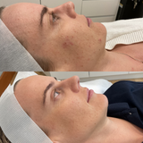 Even Tone Program – Dark Spots, Pigmentation & Uneven Tone