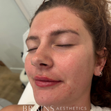 Cosmetic Aesthetics Consultation