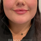 Cosmetic Aesthetics Consultation