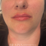 Cosmetic Aesthetics Consultation