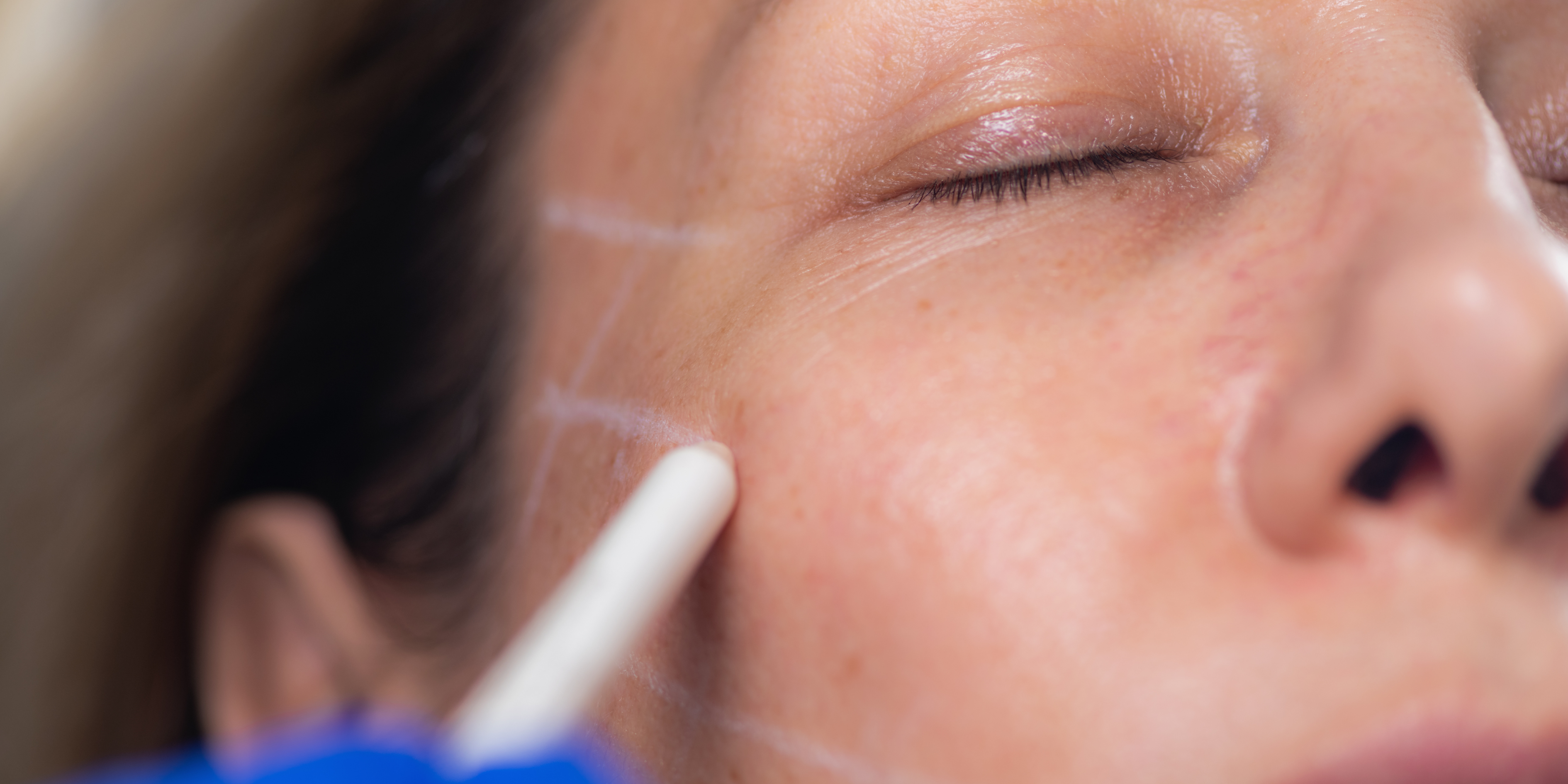 Lift and Firm, Without Losing Volume