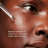 Blemish and Age Defense 30ml