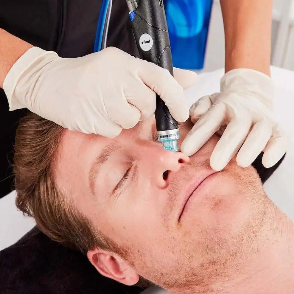 Men's HydraFacial MD treatment at Brains Aesthetics Williamstown